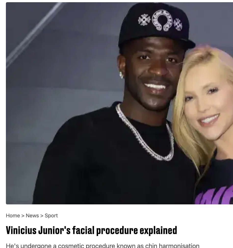 Vinicius Junior's facial procedure explained
for LadBible