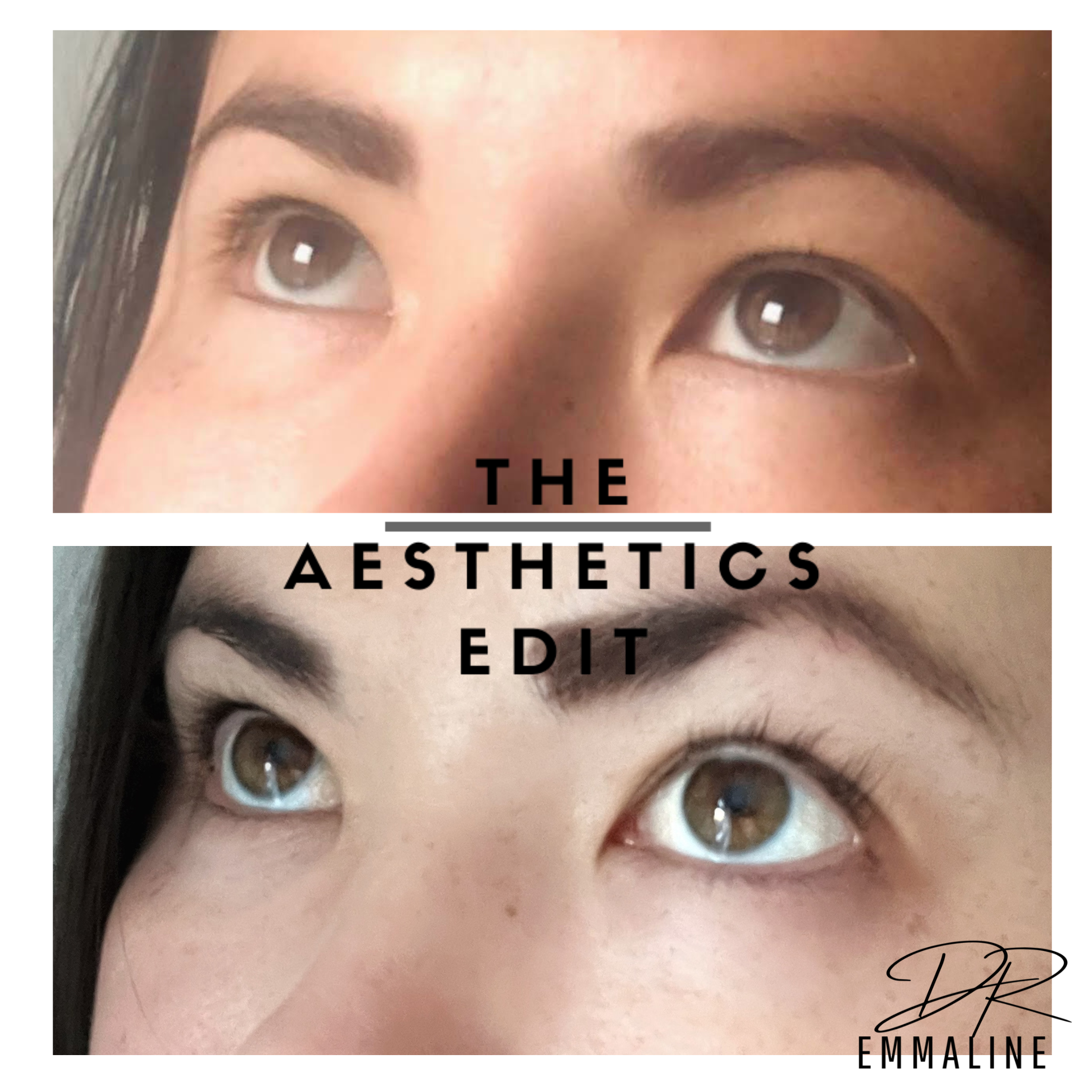 Long, Long Lashes: Do Eyelash Serums Really Work?