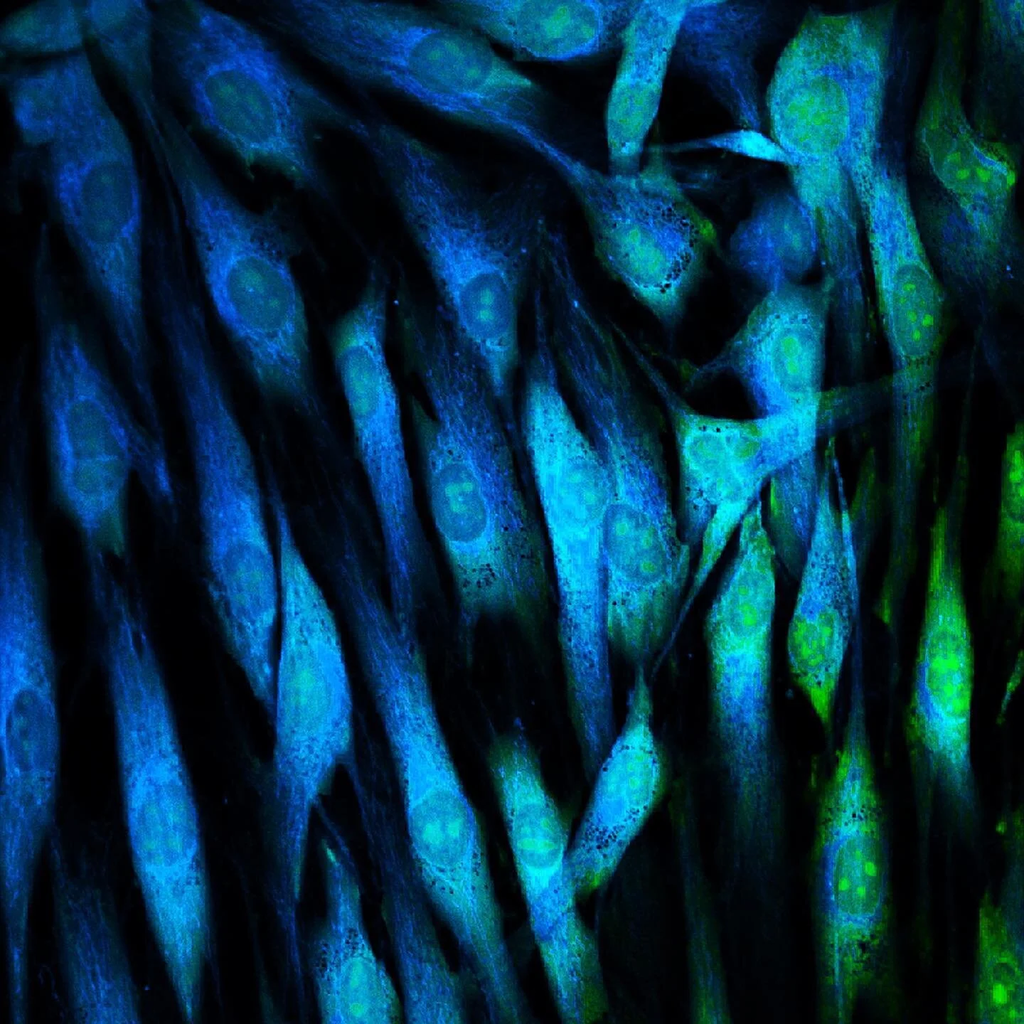 It seems that I say this every month, but **wow**. September was brimming with fantastic research news! In this edition of my Signals blog feature at @ccrm_ca, I cover the latest in our pursuit of true tissue regeneration, in vivo heart repair, an im