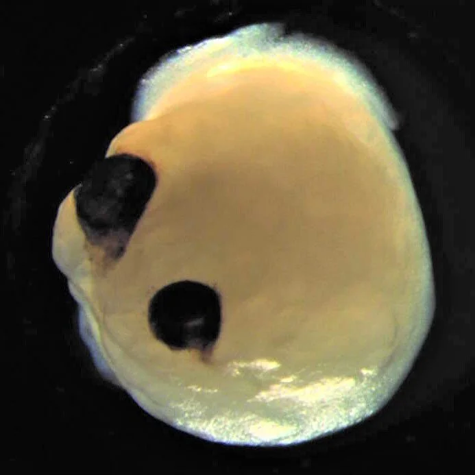 August was another packed month in regenerative medicine research news! In this edition of my feature over at @ccrm_ca Signals blog, I cover visually-equipped brain organoids (that&rsquo;s what&rsquo;s staring back at you in this photo 👀), the lates