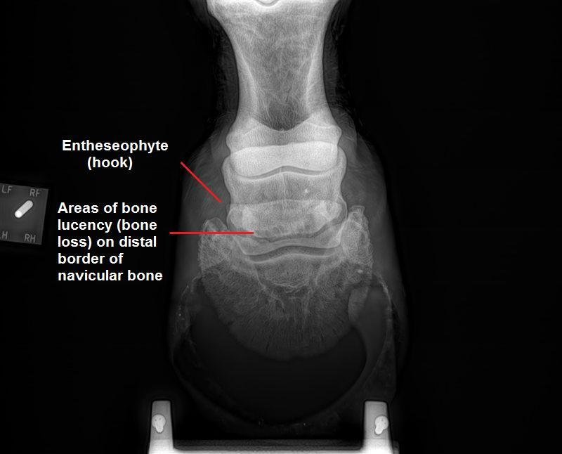 Navicular photo with text.jpg