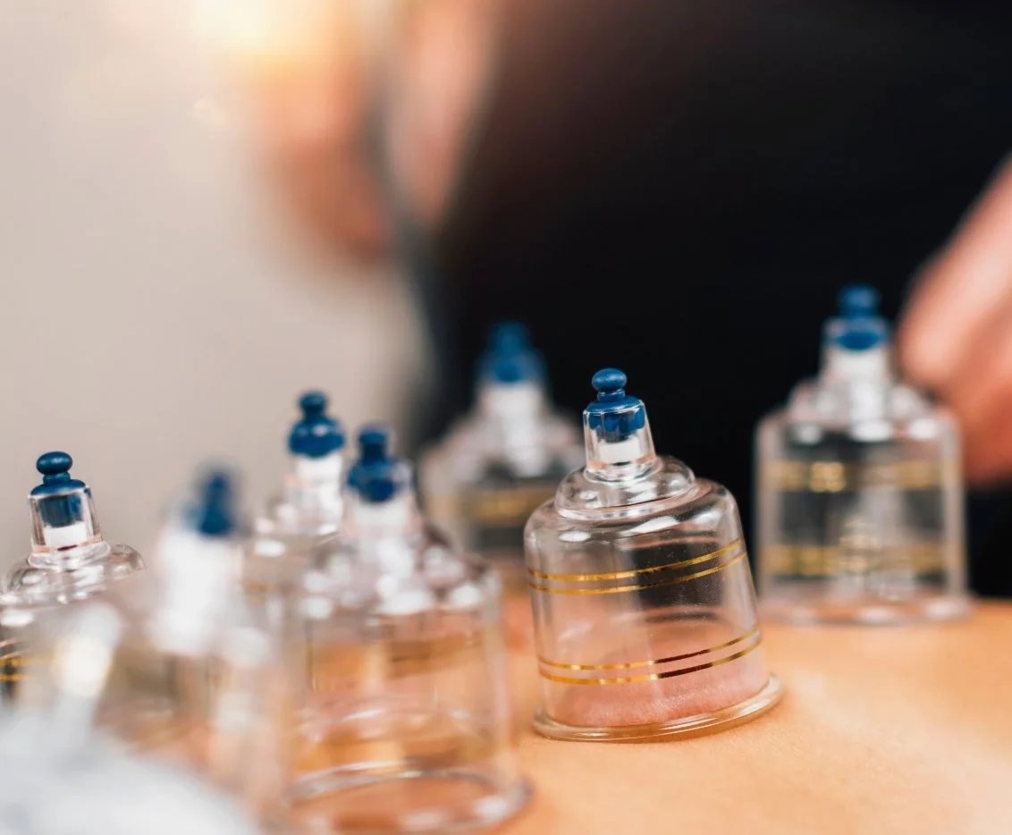 Cupping vs. Gua Sha:Which Treatment Is Right for You?