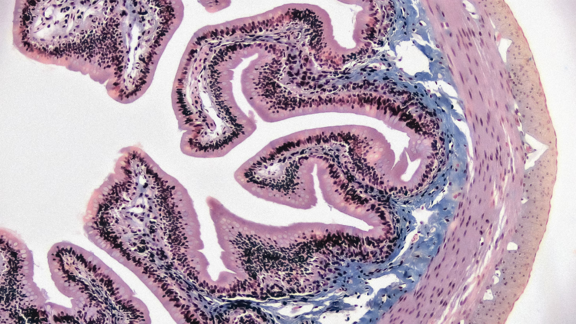 Gut Parasites: Signs of a Parasitic Infection and How to Restore Your Gut Health