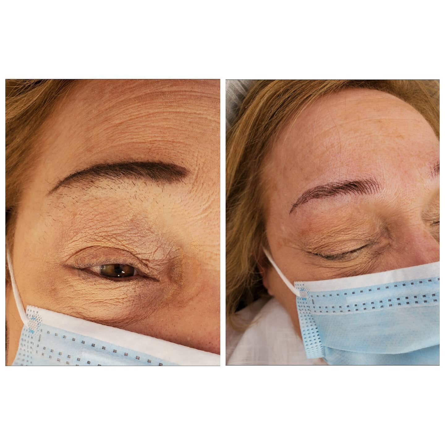 This wonder woman was referred to me with eyebrows she's been shaving and drawing in &quot;since the 70's&quot;. It was totally my pleasure to eliminate one step from that decades long routine. #paywithsmile #70saesthetic
#newlookwhodis 
#lessismore