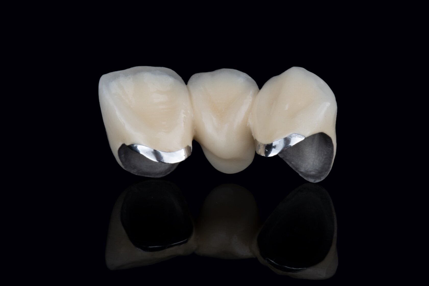 Noble PFM — MODERN DENTAL
