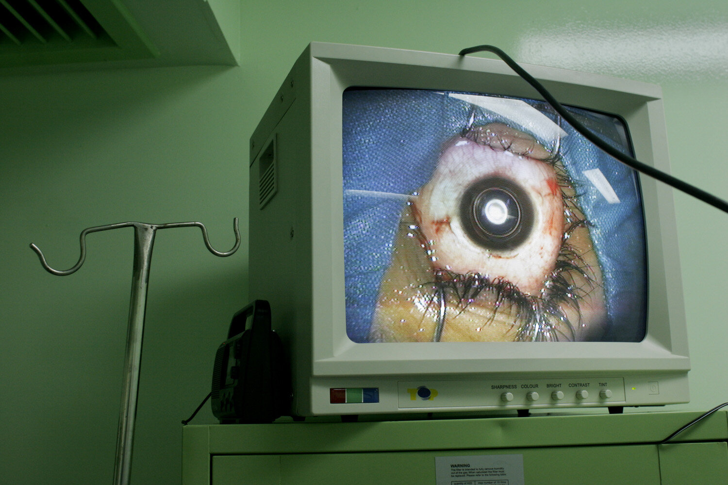  Live eye surgery on a monitor in the Pando ferrer eye clinic in Havana. 