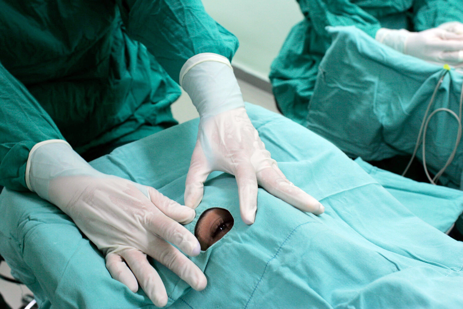  A Cuban nurse prepares a patient for a cataract surgery as part of the Operacion Milagro porgram. 