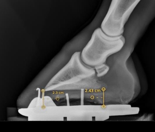 Foot balance - Sole Depth