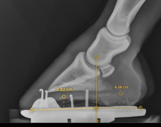 Foot balance