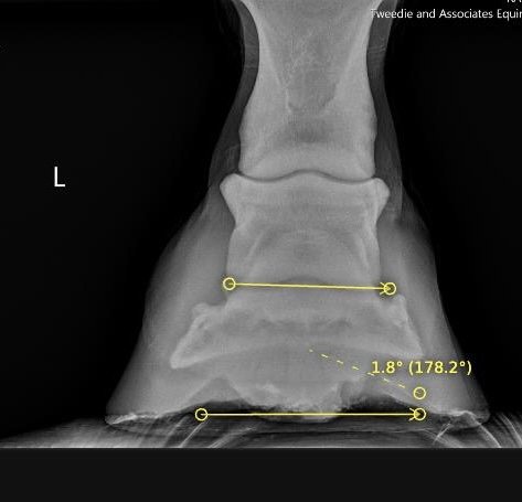 Foot measurements part 4