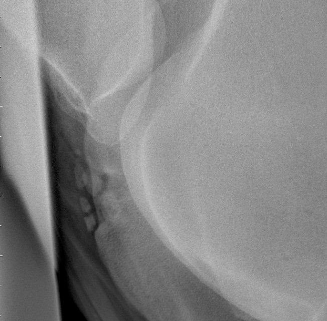 Stifle lameness