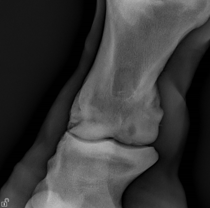 Ringbone Ring Bone in horses β Tweedie Equine Vet Services
