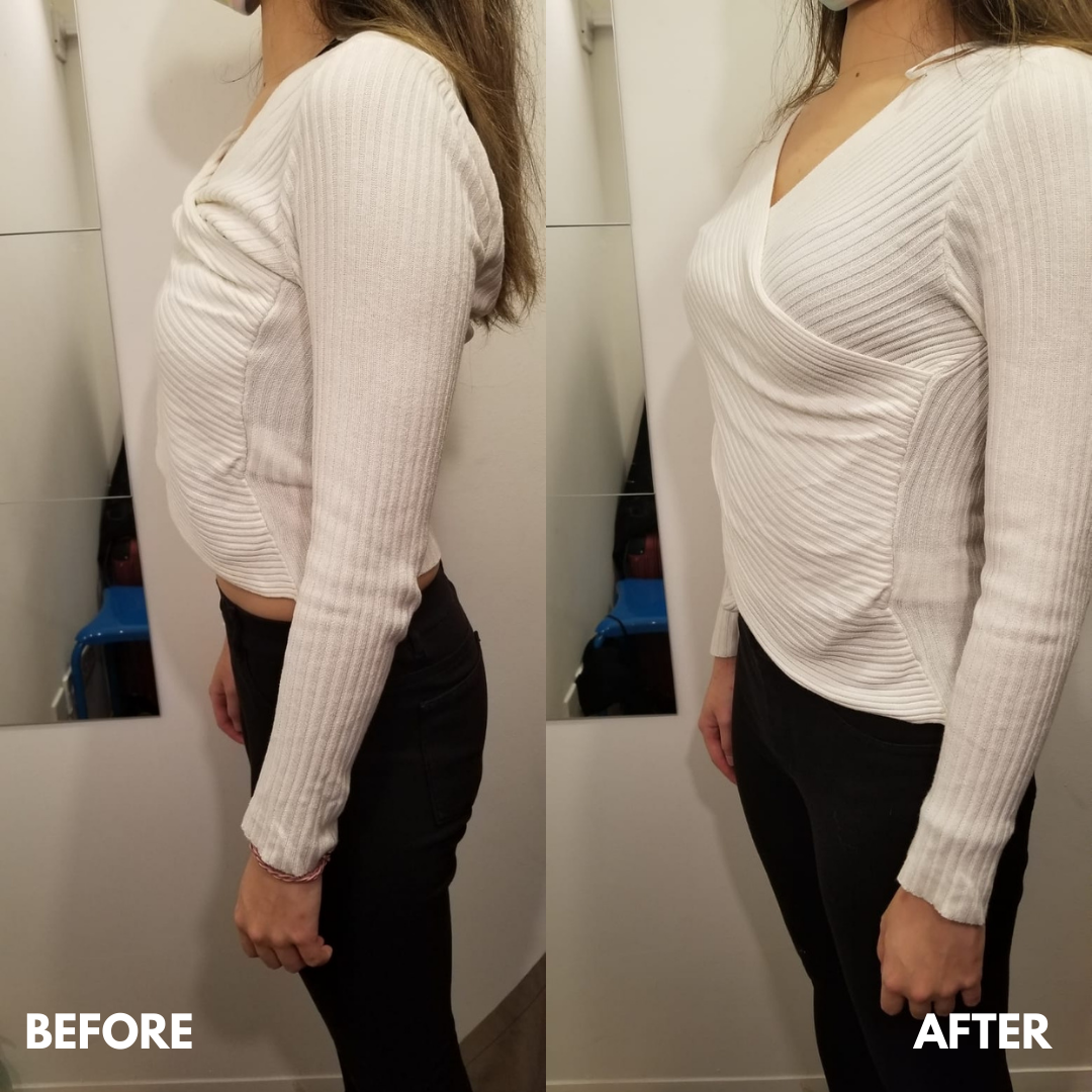 平胸可能只是錯覺？