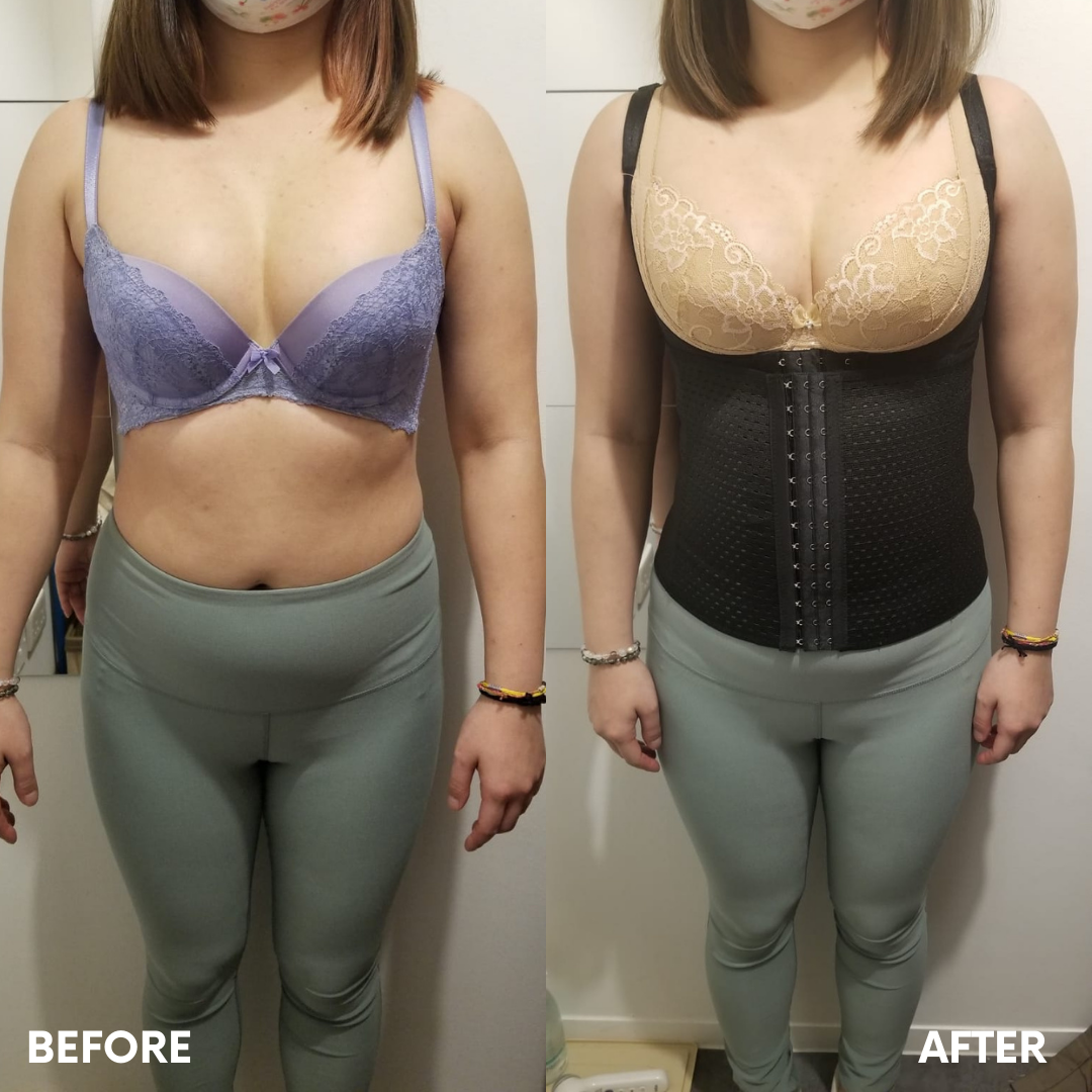 尺碼不合適的內衣，贅肉嚴重