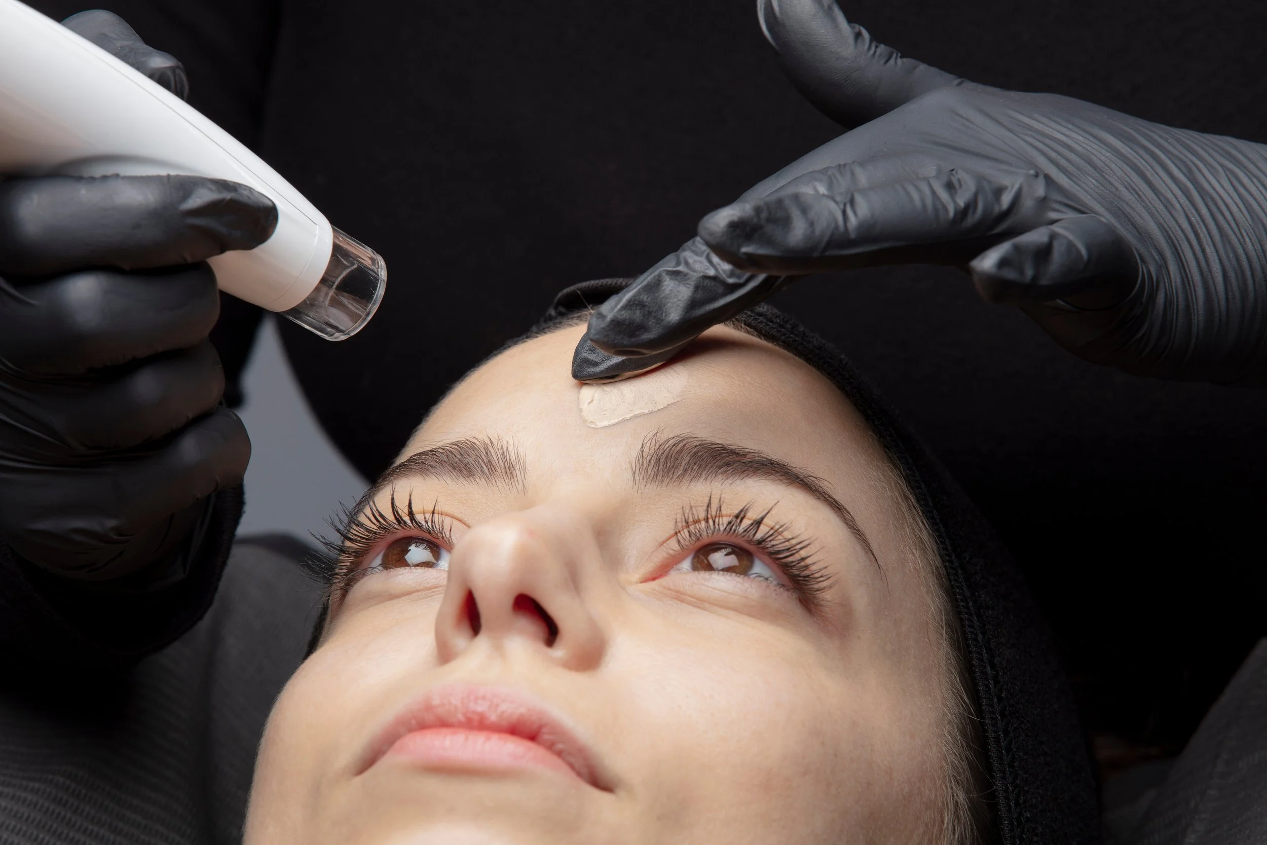 A woman receiving a skincare treatment on her forehead, with a skincare professional applying a cream or serum while wearing black gloves.