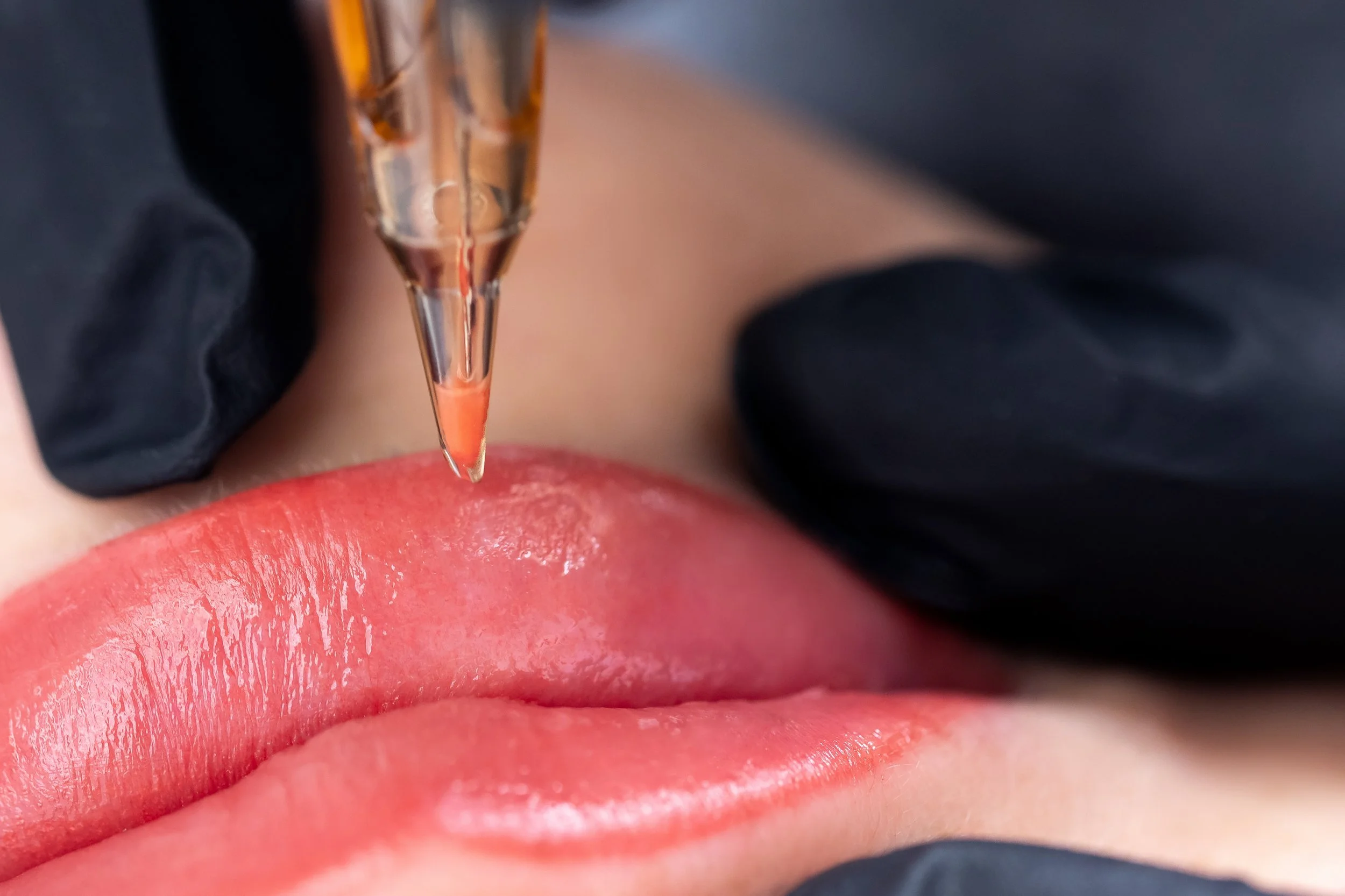 Close-up of a person receiving lip tattooing, with a tattoo needle applying pigment to the lips, wearing black gloves.