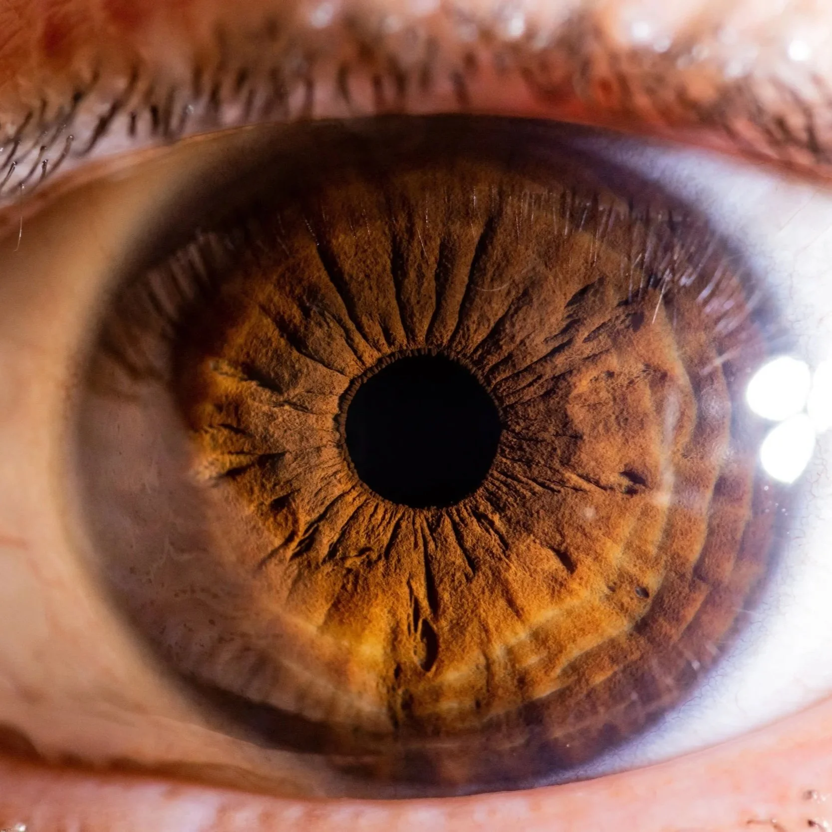 Eye Troubles Again