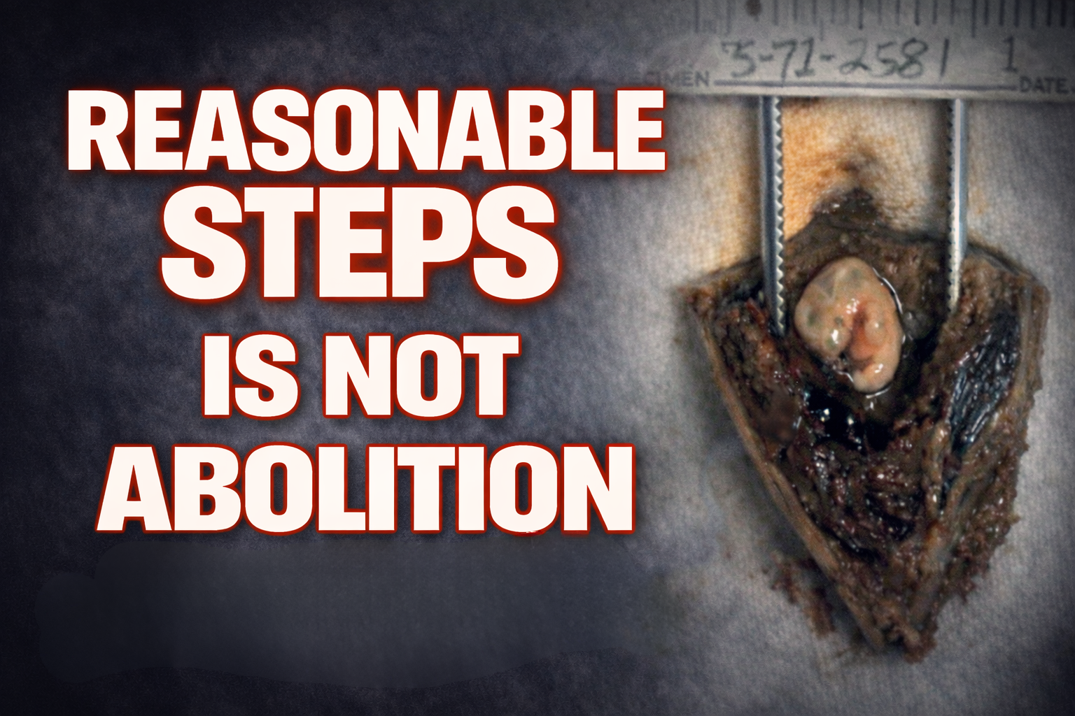 Why We Ask Christians Not to Support Duress or Reasonable Steps