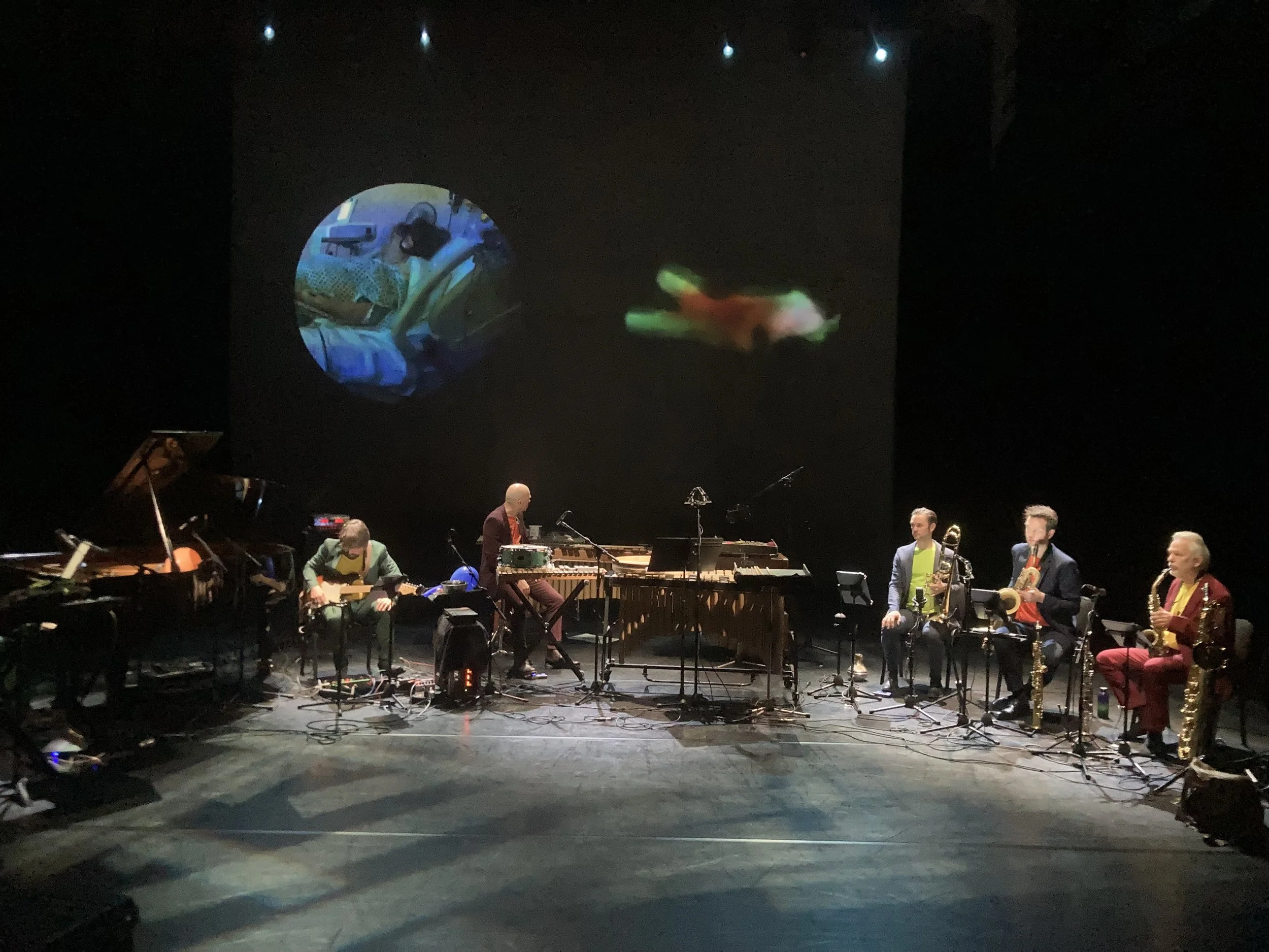 The Wonder Turner Pieces