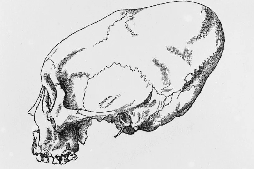 Research on the Elongated Skulls 