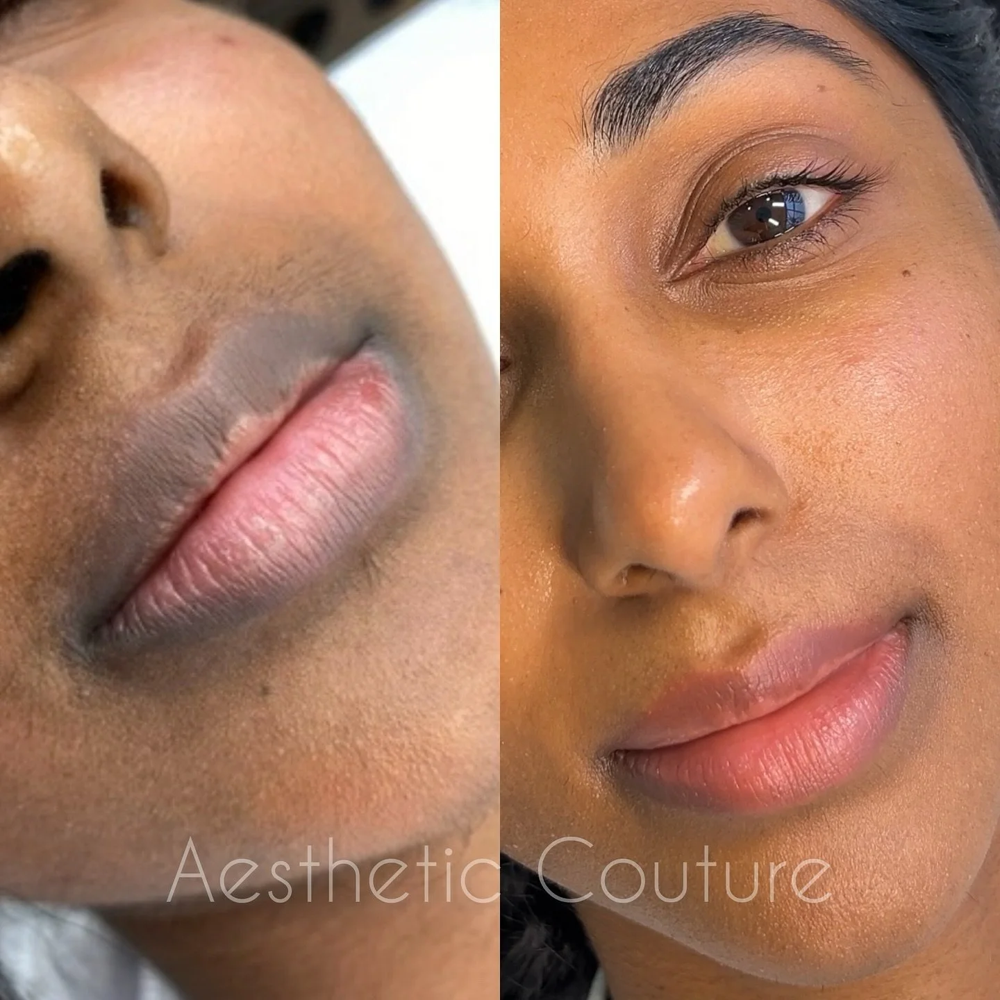 Before &amp; healed lip blush 5 years on! 

I first did @sabbyjeyxx lip blush neutralising in 2020. Fast forward 5 years she came in a few months earlier for a refresh. 

This is the healed result from our refresh session. Wow what a difference from 