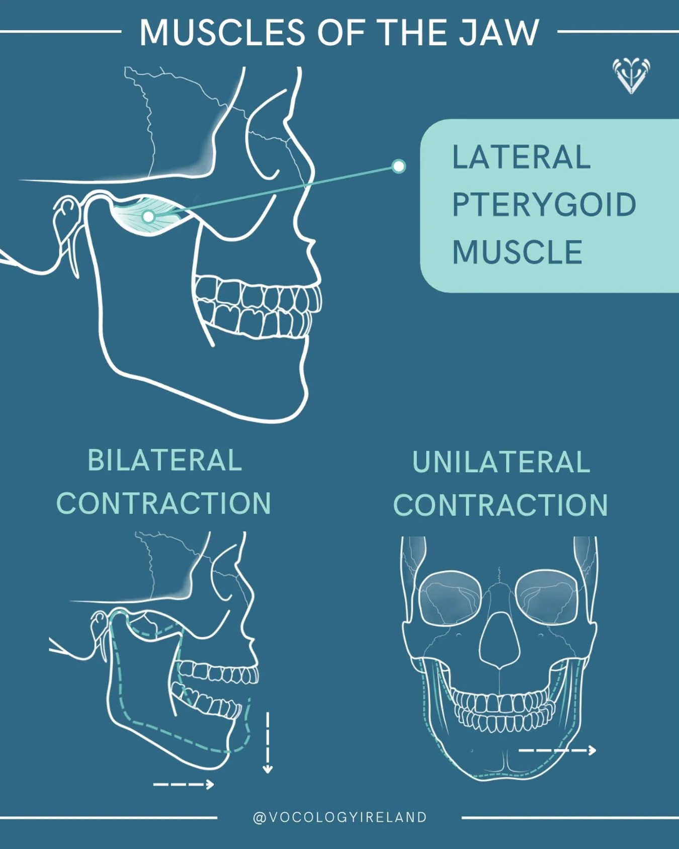 #AnatoMonday: lateral pterygoid muscles!

This is a two-headed fan-shaped muscle, which runs from your sphenoid bone to your TMJ.

👉 Bilateral contraction (using BOTH your left and right lateral pterygoid muscles) would protrude and lower the mandib