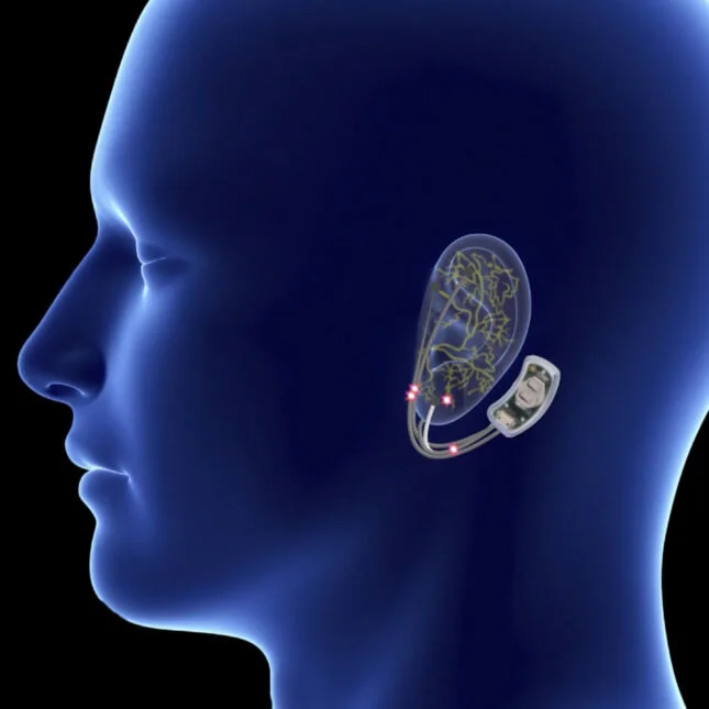 How does the Bridge...jpg