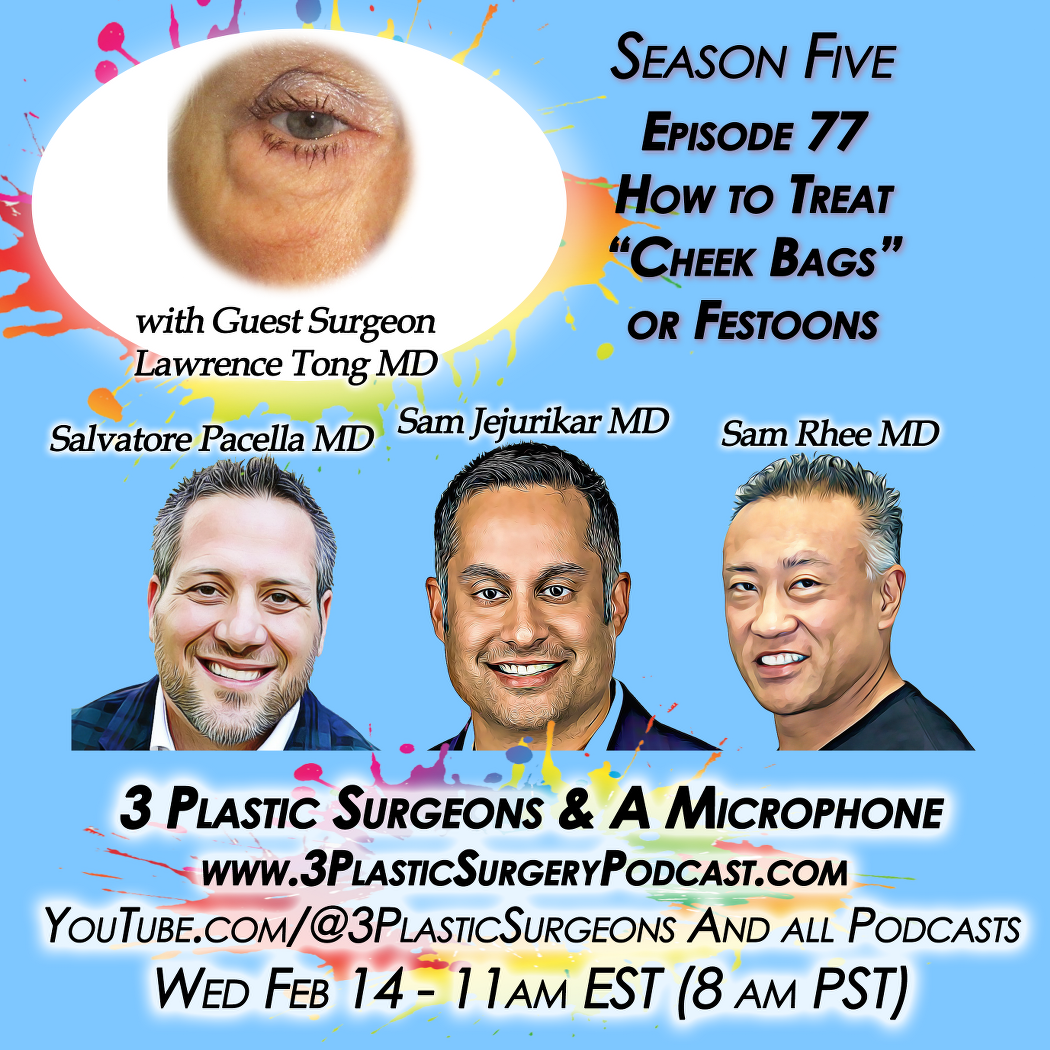 S05E77 The Art and Science of "Cheek Bag" or Festoon Treatment