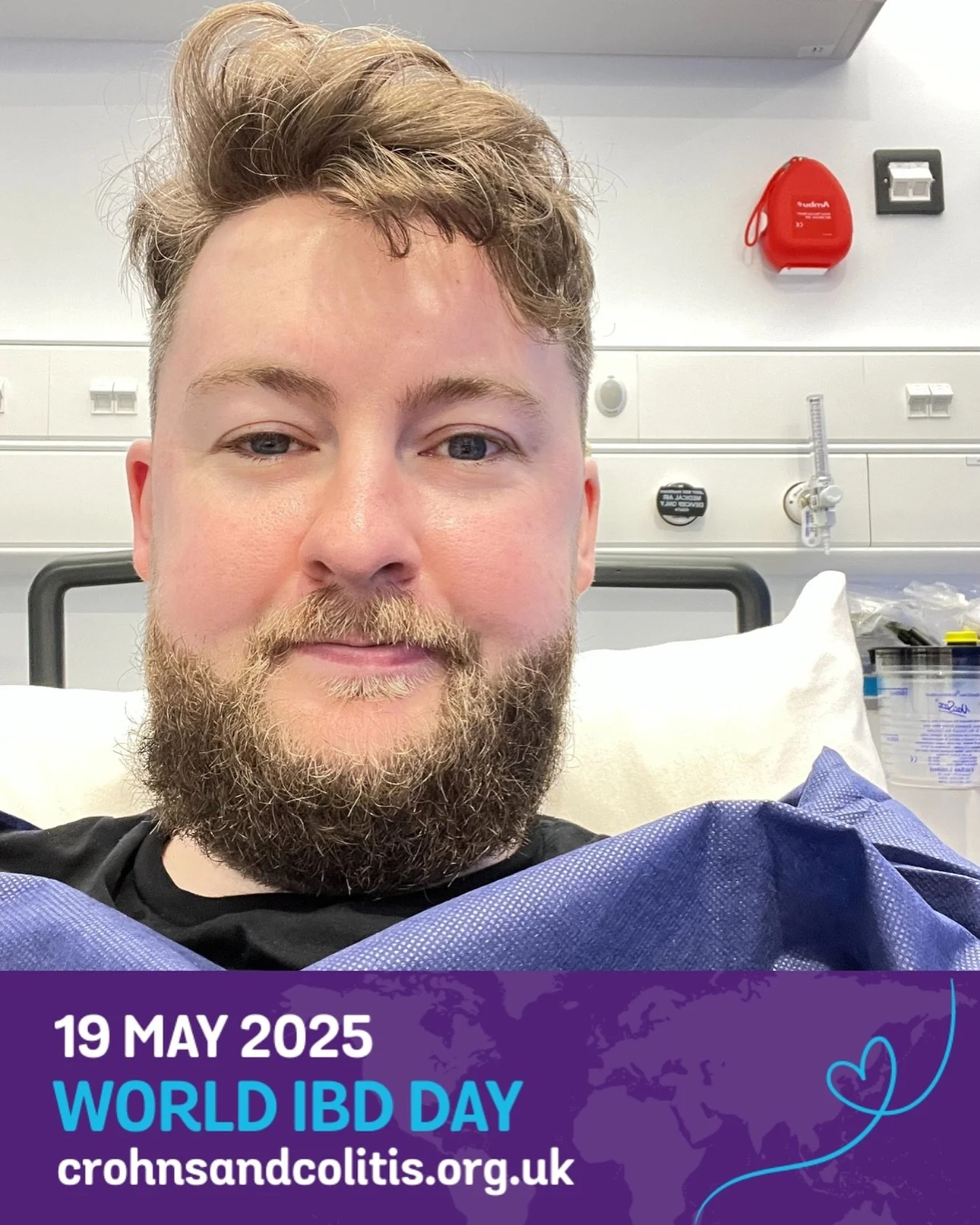 World IBD Day! This one&rsquo;s for all my dodgy bowel friends 😂💩

In 2012 I was diagnosed with Ulcerative Colitis, a form of Inflammatory Bowel Disease (IBD). 

More than 500,000 people in the UK are living with Crohn&rsquo;s or Colitis, with 25,0
