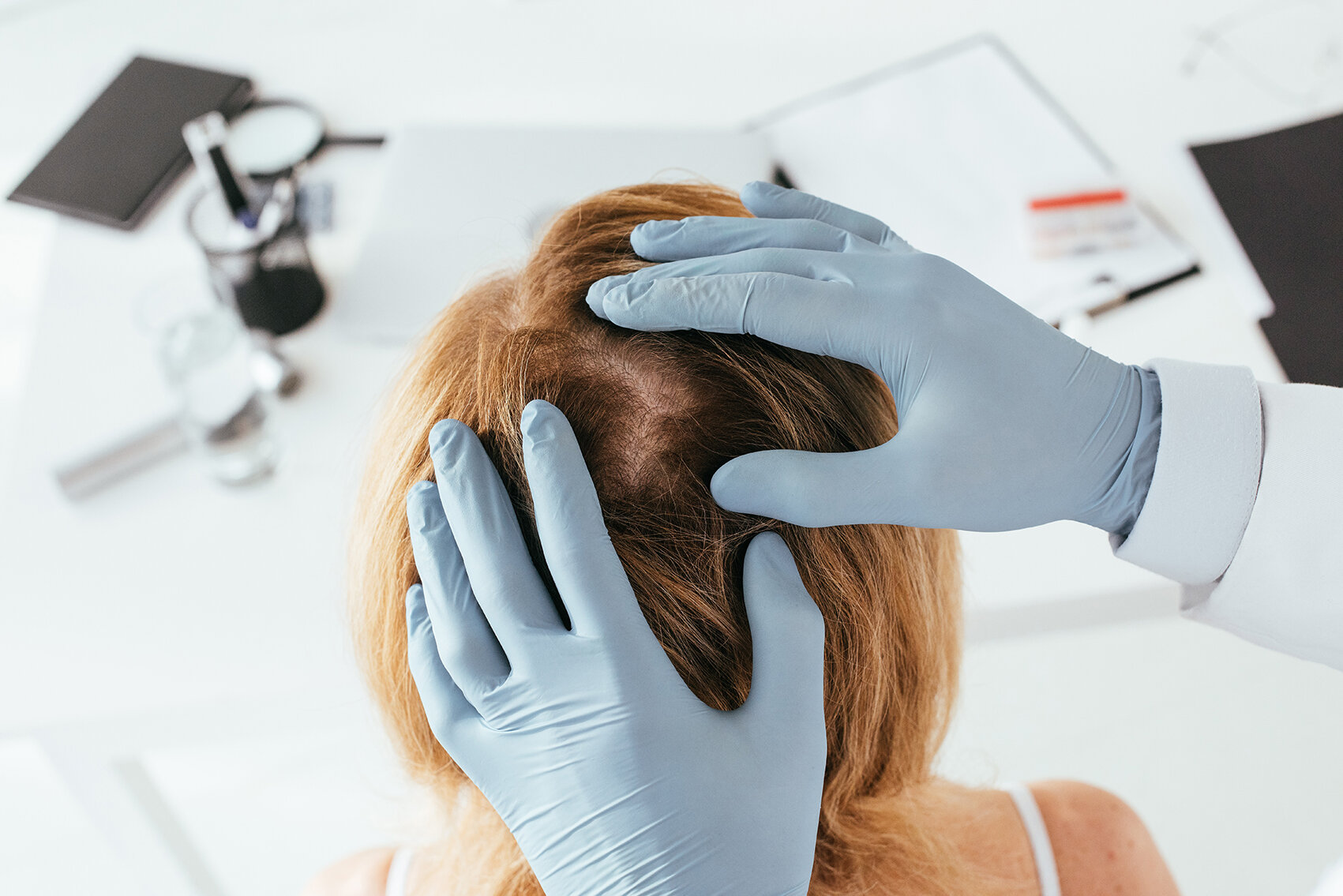 Hair Loss and scalp disorders Brisbane — Skin Partners | Brisbane  Dermatologist | Hair Loss Specialist Brisbane| General, Surgical, Laser  Dermatology