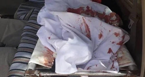 Dilal ka dhacay Muqdisho.