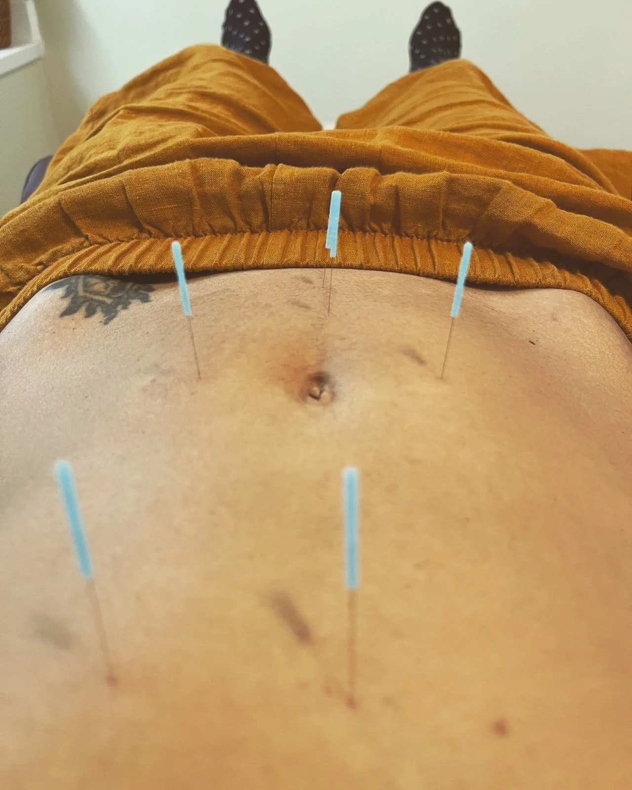 Case Study: “Front Wheel of Life” for Digestive Issues