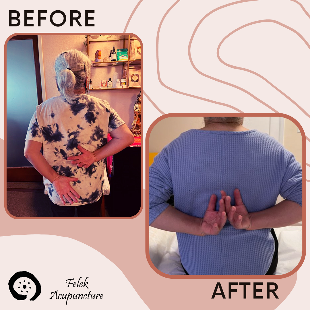 Case Study: Shoulder pain and limited range of movement