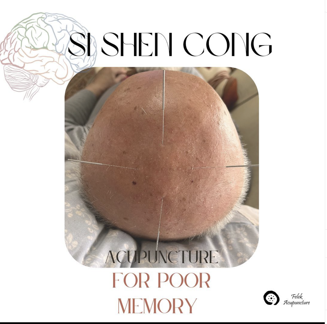 How can Chinese Medicine help with memory loss?