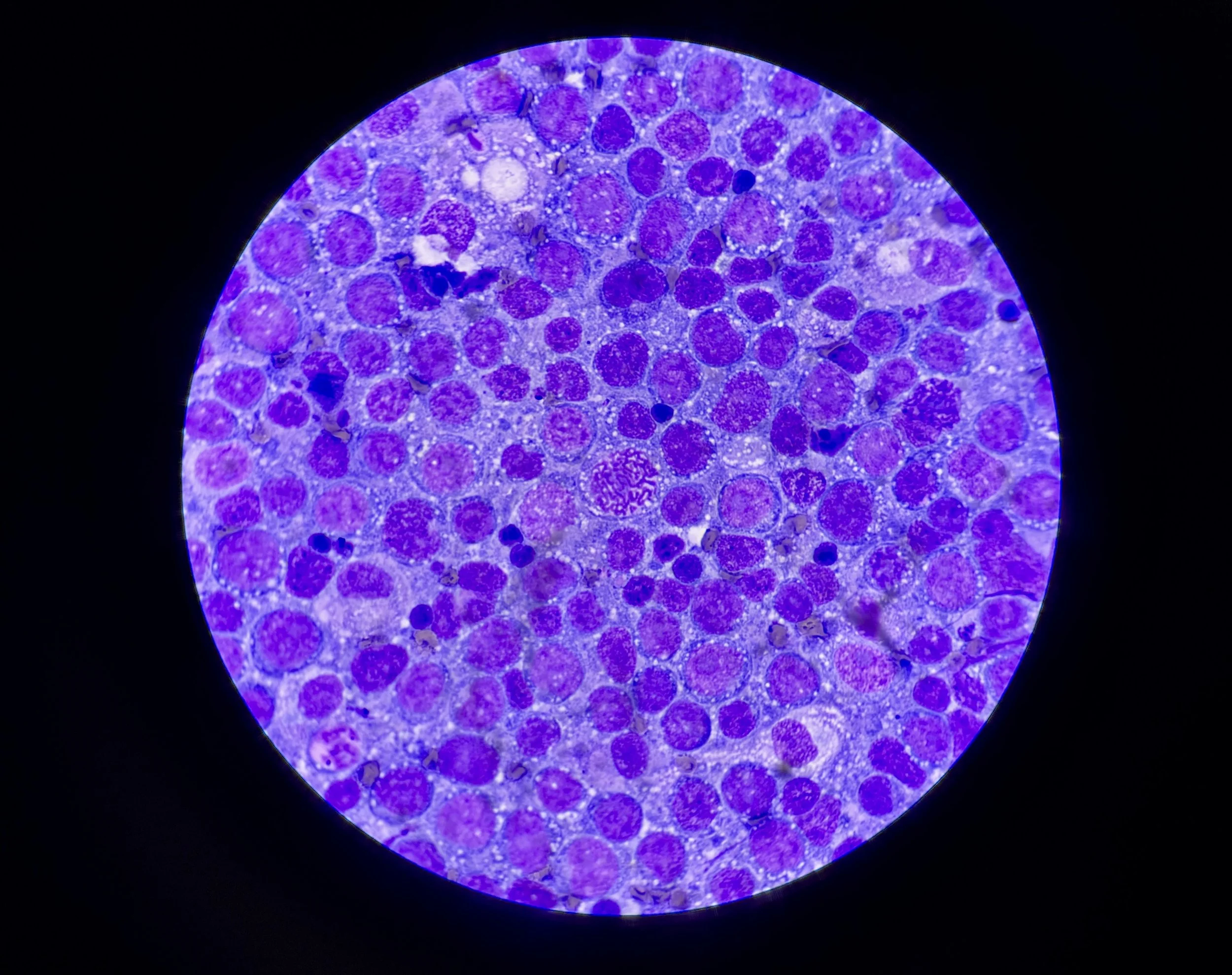 Aspirates of skin lumps to check for cancer.