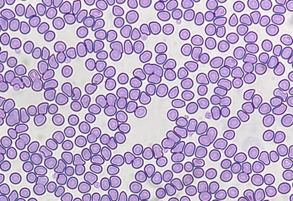 Blood smear examinations to check for conditions like anaemia, leukaemia, or tick fevers.