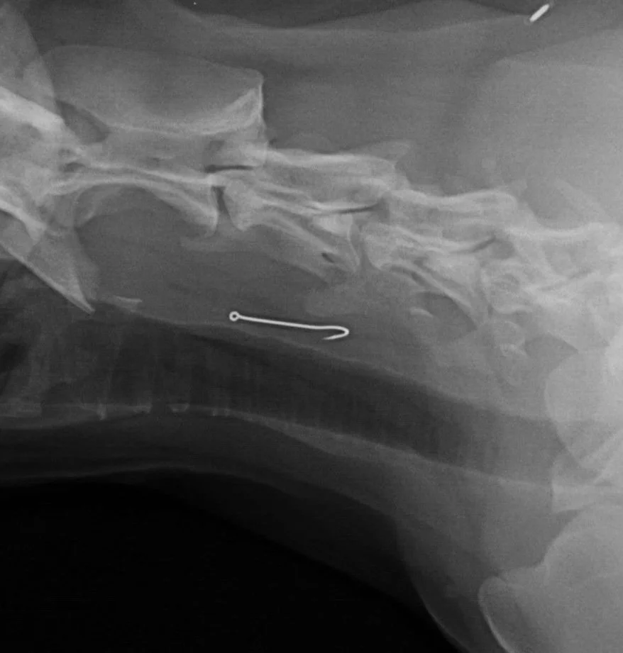 X-ray of a neck showing a fishhook lodged in the soft tissue.