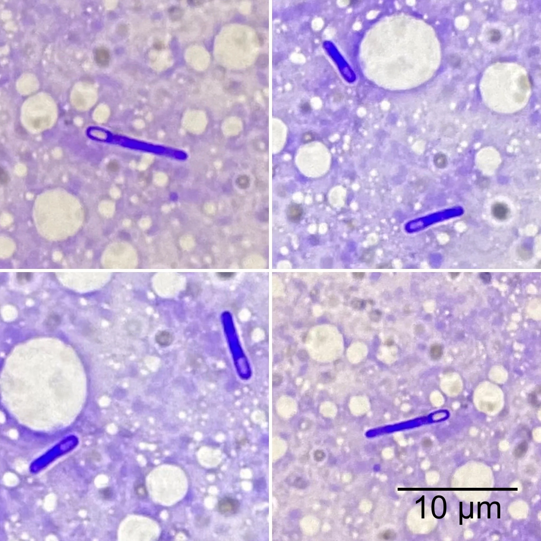 Close-up microscopic image of spherical white particles and blue rod-shaped bacteria on a purple background with a scale bar stating 10 micrometers.