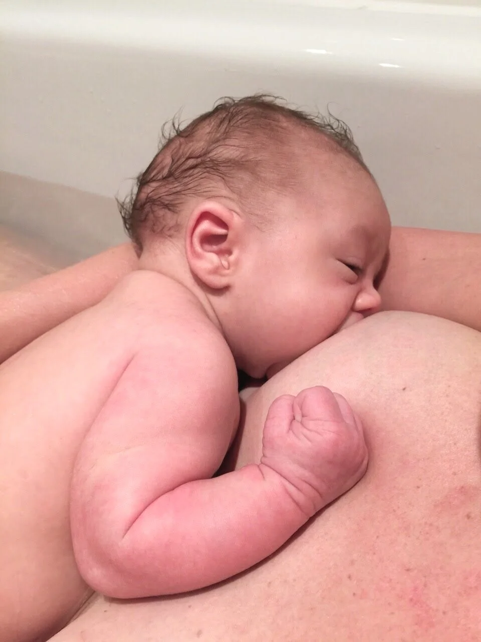 Breastfeeding a child with a cleft lip