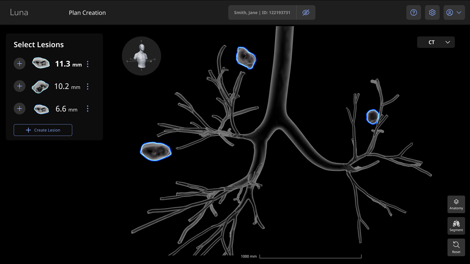 No lesion selected, default tree view on entry.png