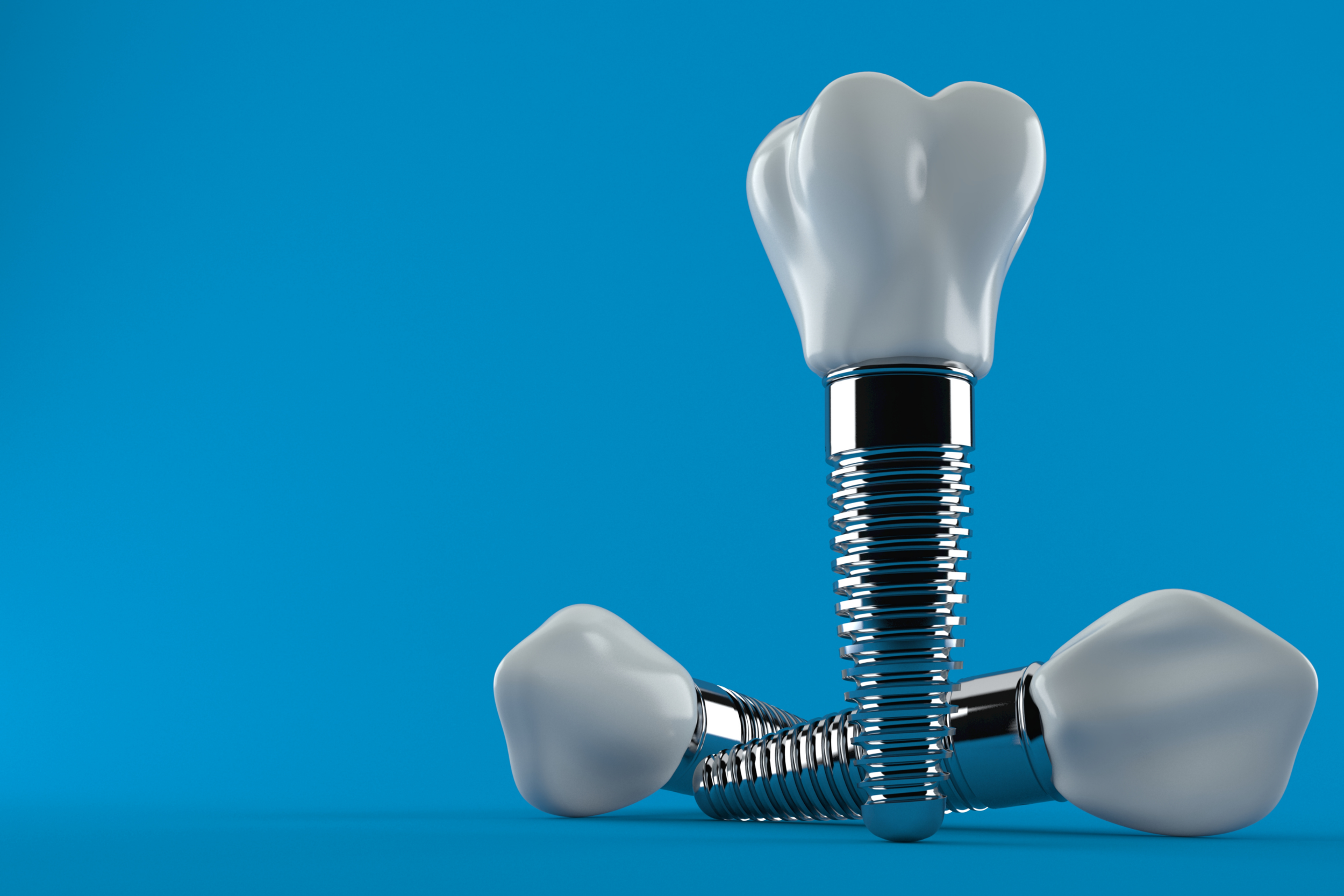 What’s Better: A Dental Implant or a Bridge?