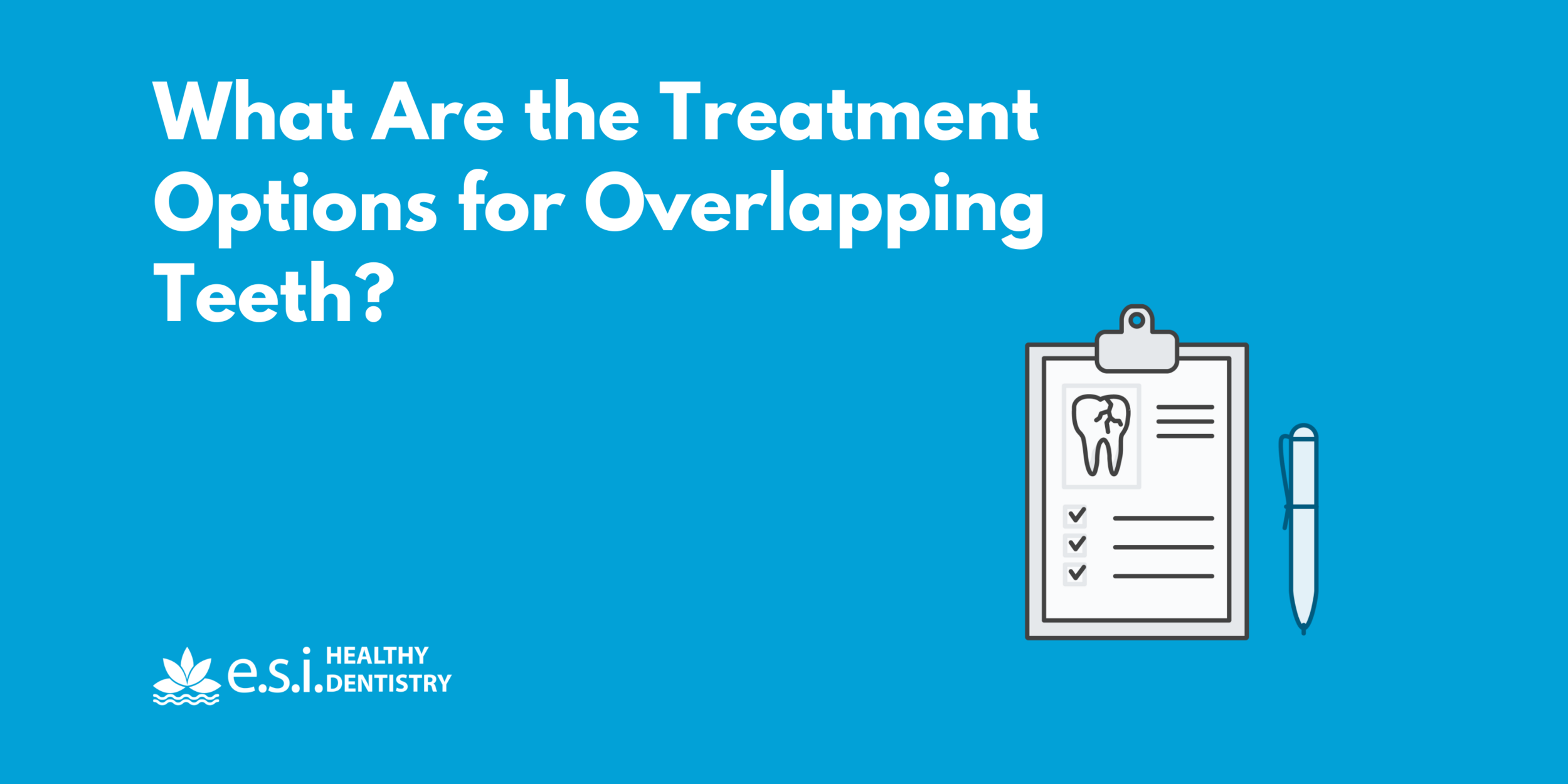 What Are the Treatment Options for Overlapping Teeth?