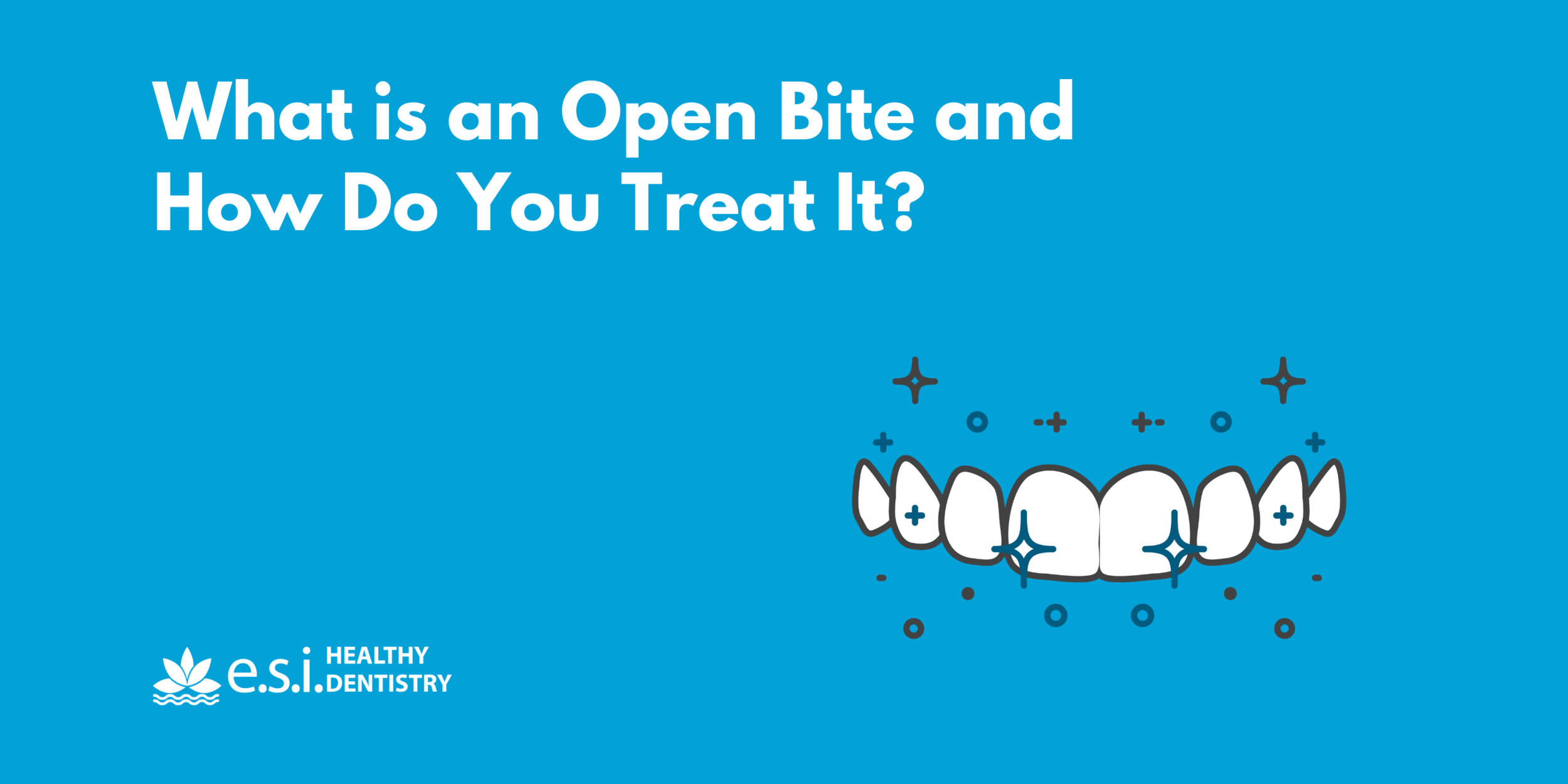 What is an Open Bite and How Do You Treat It?