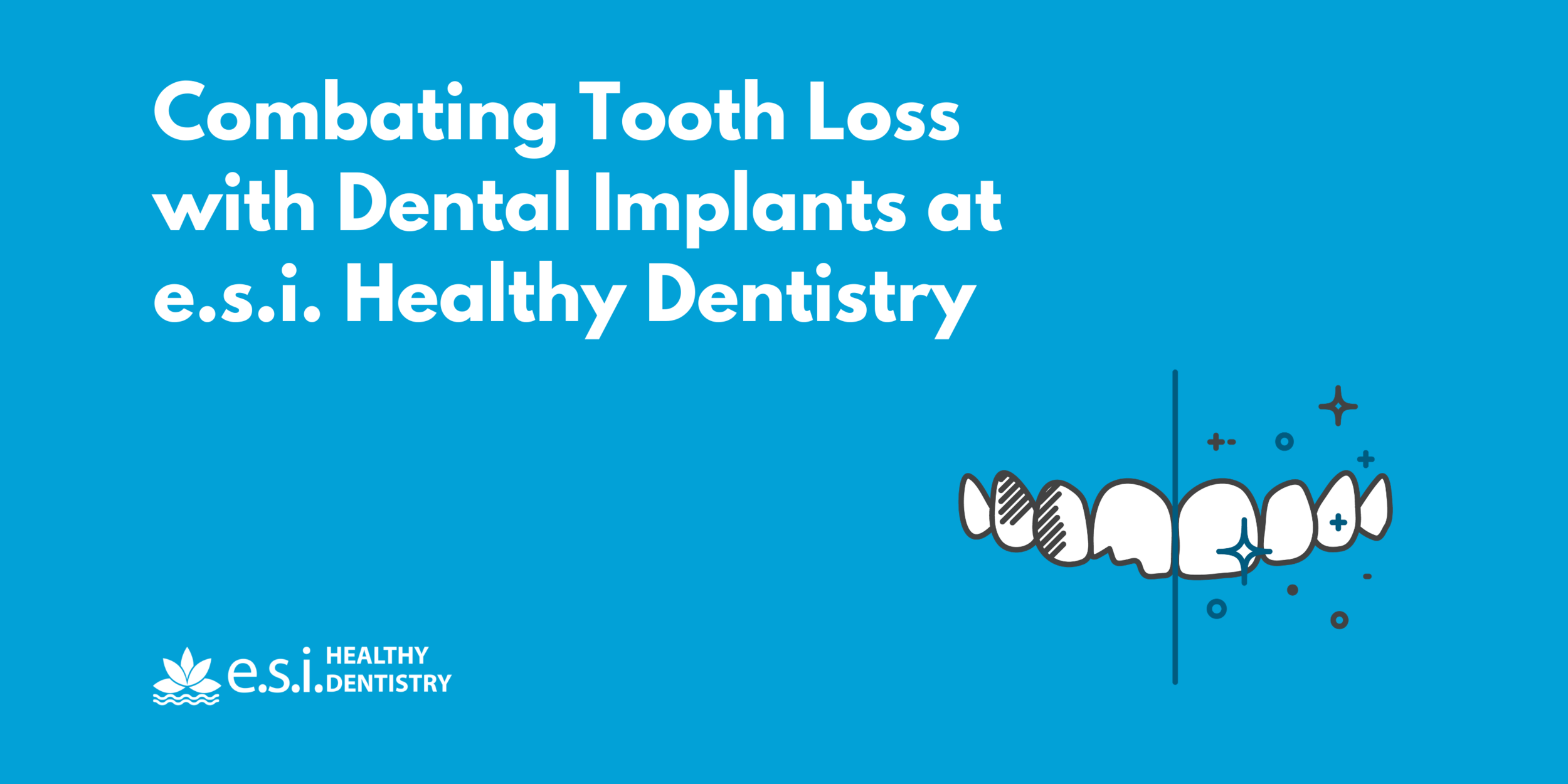 Combating Tooth Loss with Dental Implants at E.S.I. Healthy Dentistry