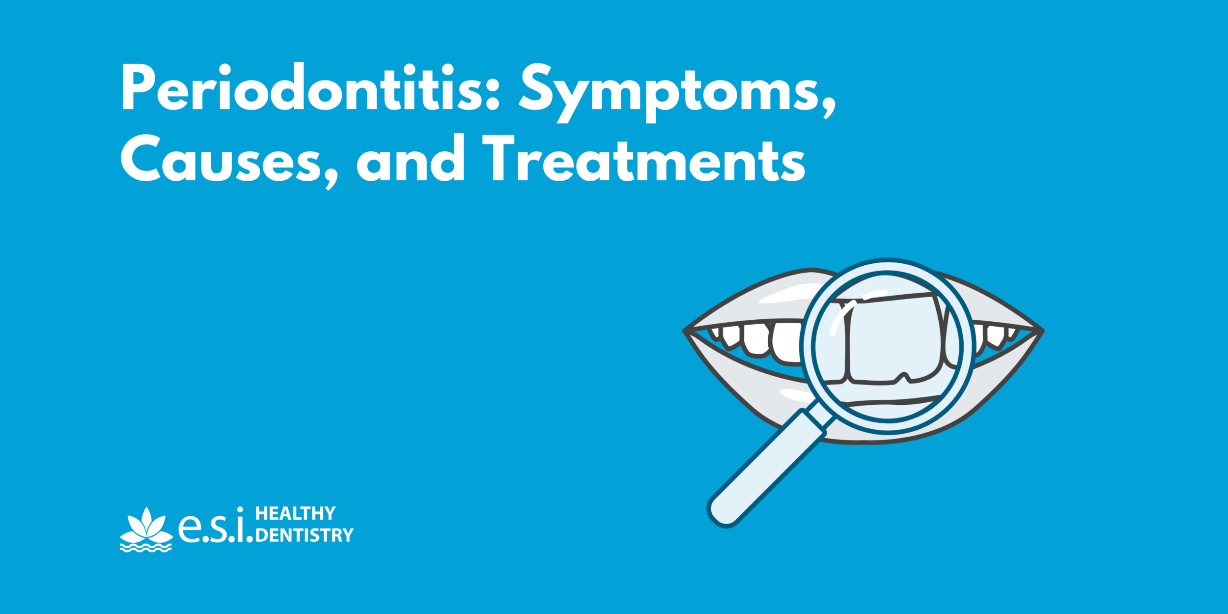 Periodontitis: Symptoms, Causes, and Treatments