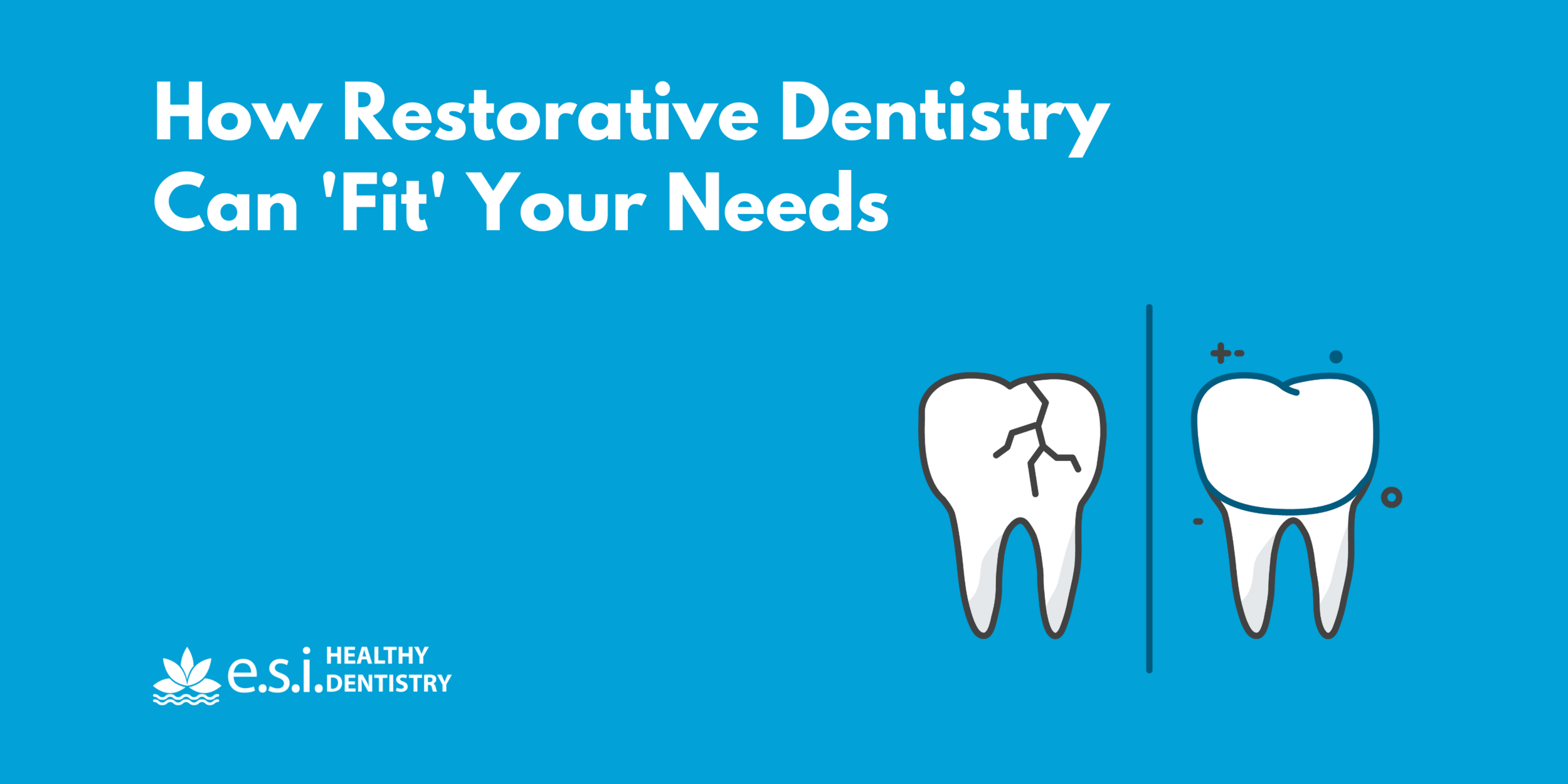 How Restorative Dentistry Can 'Fit' Your Needs