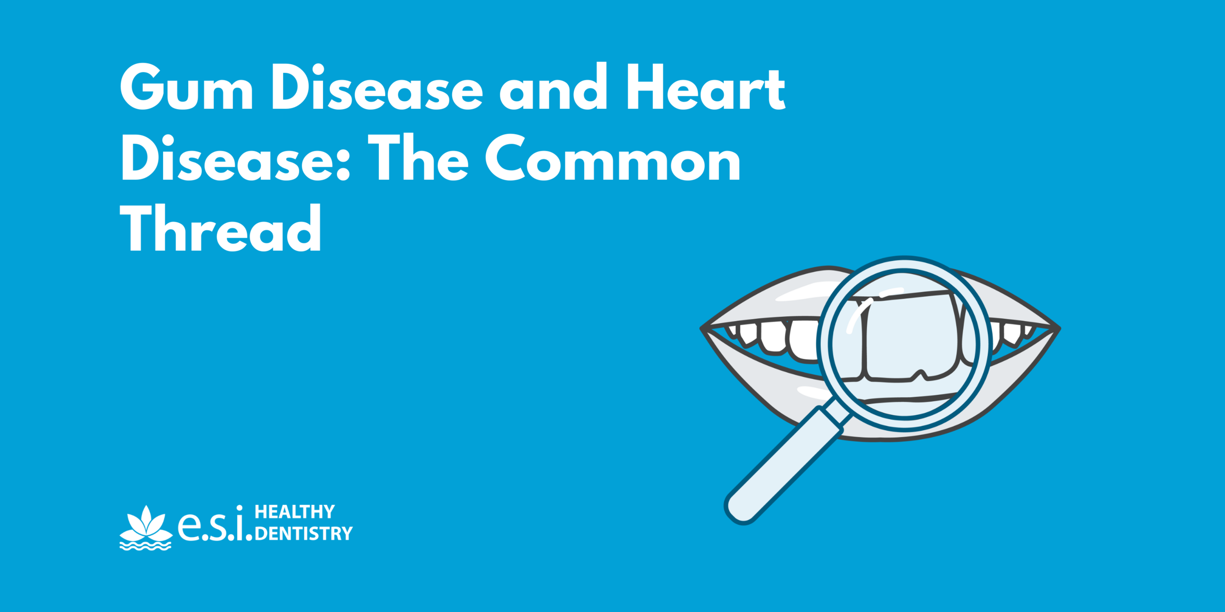 Gum Disease and Heart Disease: The Common Thread
