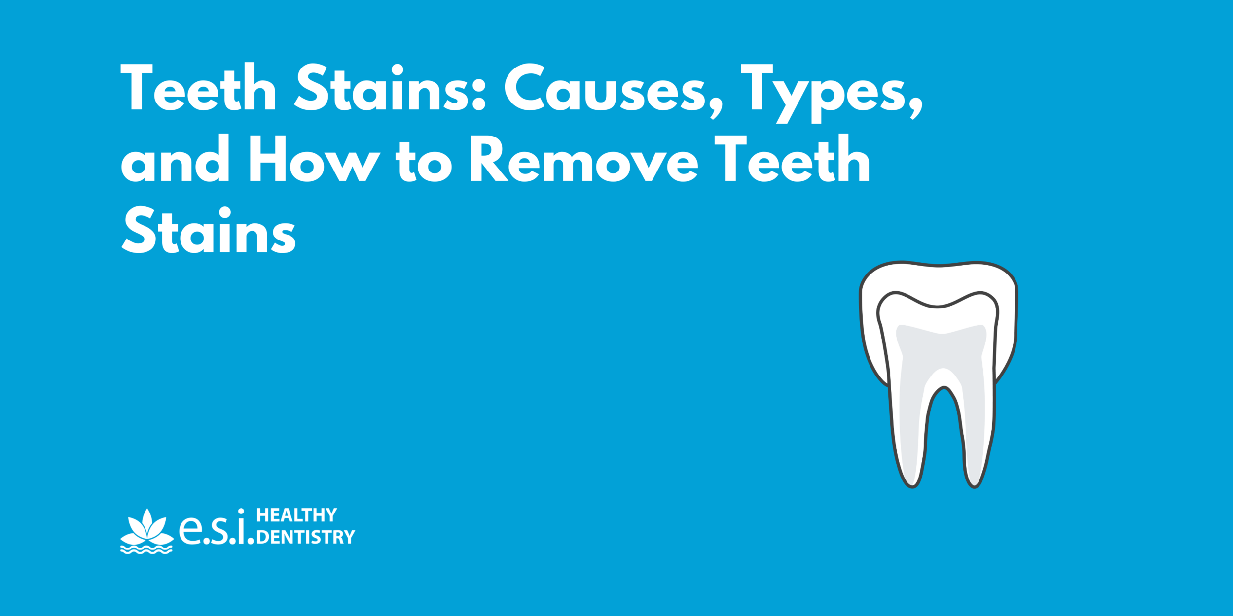 Teeth Stains: Causes, Types, and How to Remove Teeth Stains
