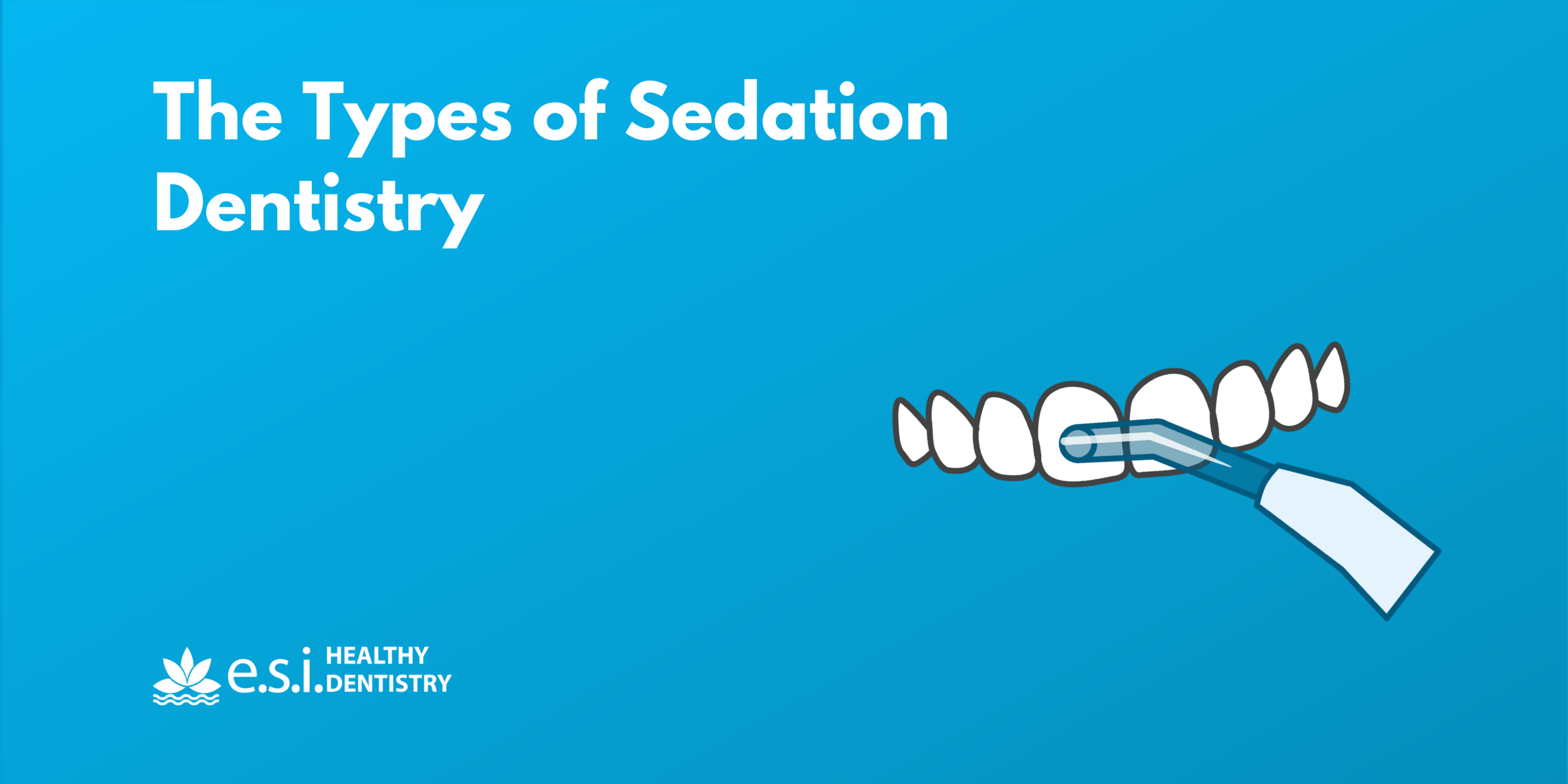 The Types of Sedation Dentistry