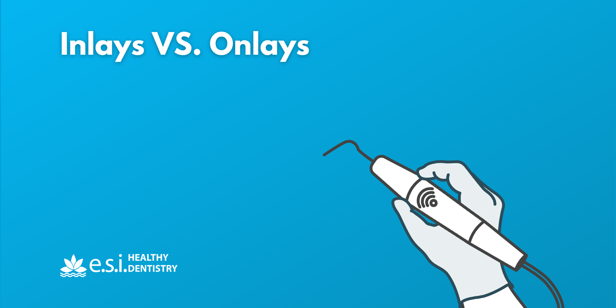 Inlays VS. Onlays